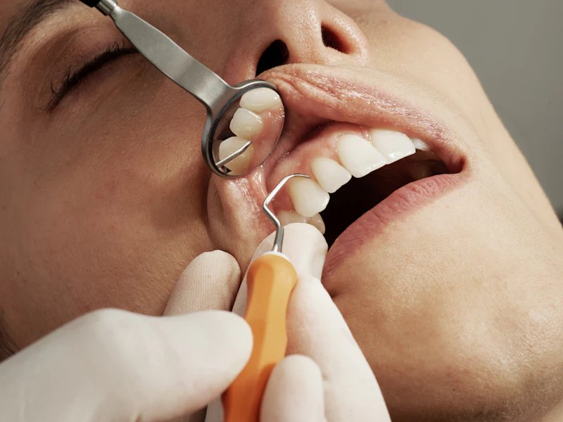 Dental Health at Health Global Point
